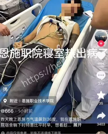 心源性猝死