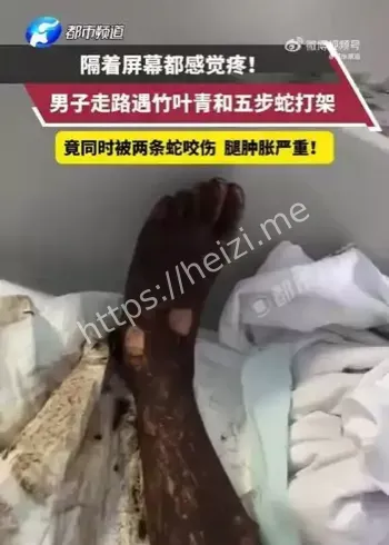 五步蛇