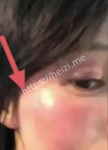 王雨馨家暴流产