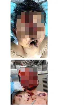 精神科门诊暴力事件