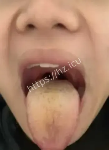 前女友怒曝