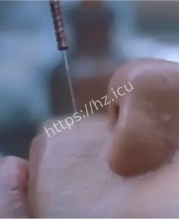 鬼门十三针第十三针风险