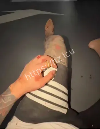 赵俊逸车库群殴