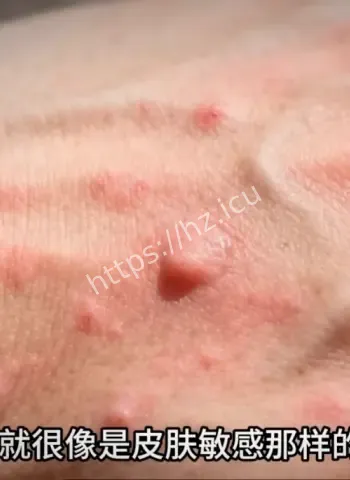 降头师药降真实案例